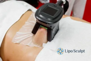 Does Fat Freezing At Home Work? 3 Fat freezing at home from Lipo Sculpt East Malling